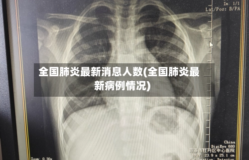 全国肺炎最新消息人数(全国肺炎最新病例情况)-第1张图片