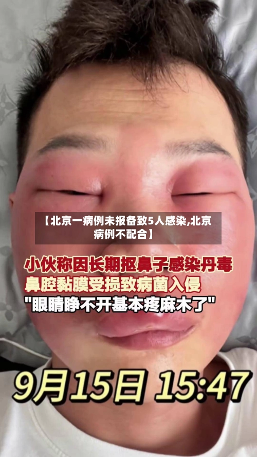 【北京一病例未报备致5人感染,北京病例不配合】-第1张图片