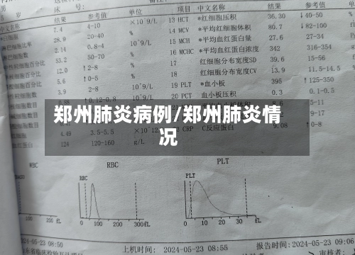 郑州肺炎病例/郑州肺炎情况-第1张图片