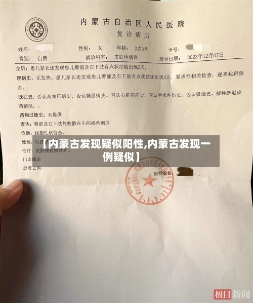 【内蒙古发现疑似阳性,内蒙古发现一例疑似】-第2张图片